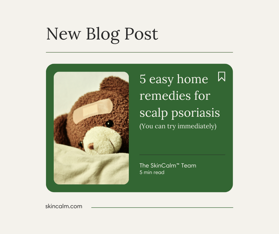 5 Easy Home Remedies for Scalp Psoriasis