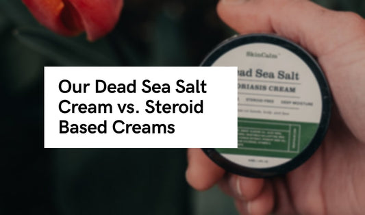 Dead Sea Salt Cream vs. Steroid-Based Creams