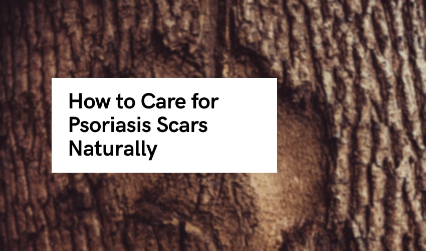 How to Remove Psoriasis Scars Naturally